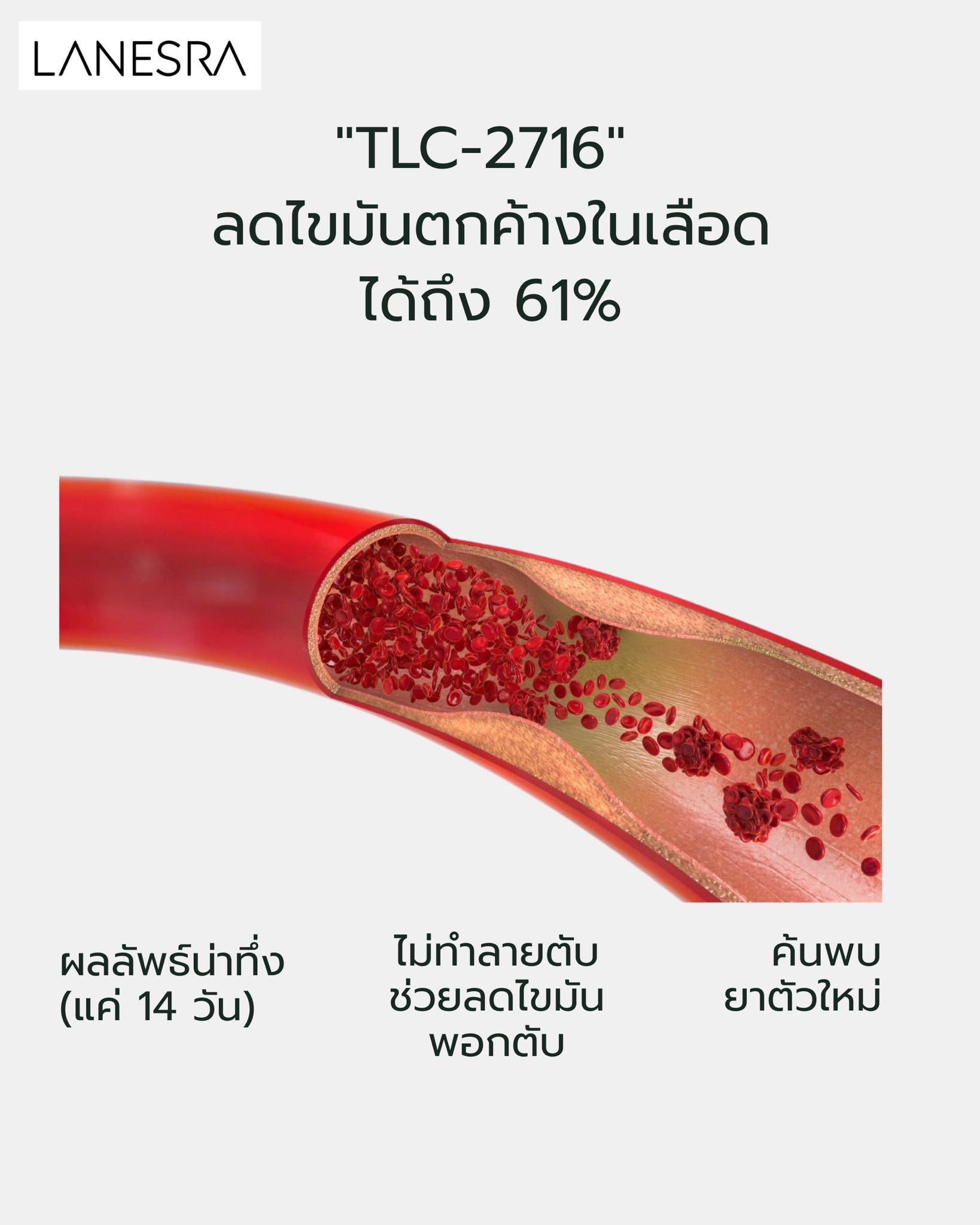 ความหวังใหม่! ยาเม็ด “TLC-2716” ลดไขมันตกค้างในเลือดได้ถึง 61% โดยไม่ทำลายตับ